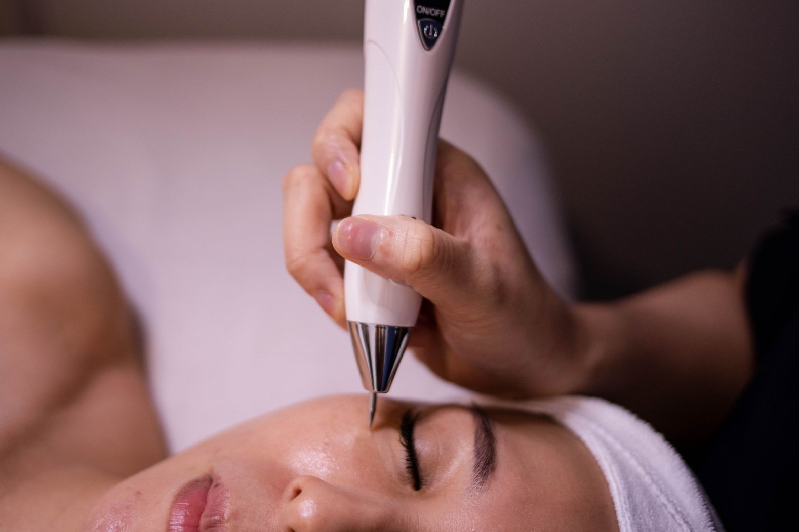 Mole Removal Near Me Options and Treatment Information